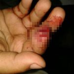 غدًا.. تدشين مستشفى #الطائف الجديد على ثلاث مراحل