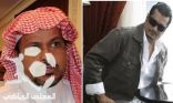 البكيري :   ينتقد مدير المنتخب بقسوة  بسبب تجاهله